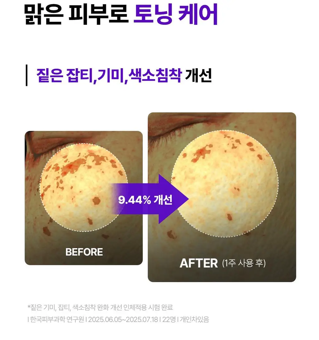 [1등 크림/손상장벽 애프터케어] 센텔리안24 마데카 크림 PDRN 기획세트 50ml+15ml 상세페이지 23